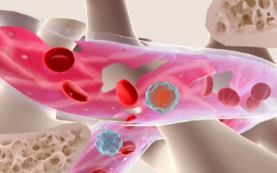 Osteoporose – Wenn die Knochen an Stabilität verlieren